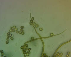 Trichia crateriformis