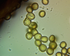 Trichia crateriformis