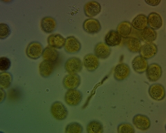 Perichaena corticalis