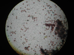 Physarum melleum