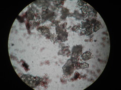 Physarum melleum