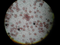 Physarum melleum