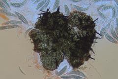 Acanthostigma minutum