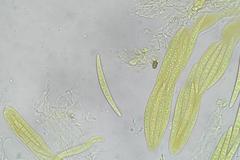 Acanthostigma minutum