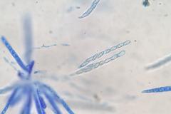 Lentomitella crinigera