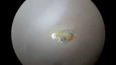 Brachidontes
