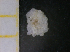 Planorbulina mediterranensis