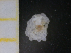 Planorbulina mediterranensis