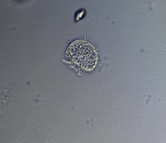 Cochliopodium