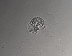 Cochliopodium