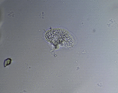 Cochliopodium