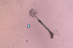 Clastoderma debaryanum