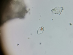 Cocconeis placentula