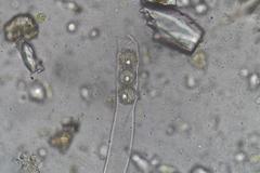 Octospora maireana