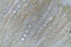 Pulvinula tetraspora