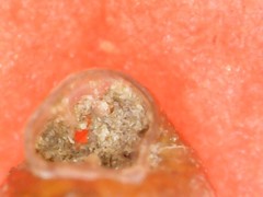 Vertigo pygmaea
