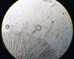 Pseudoplectania vogesiaca