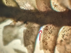 Lophoziopsis