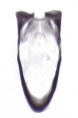 Philotarsidae