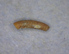 Caecum dextroversum