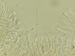 Artomyces cristatus