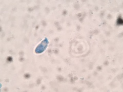 Flagelloscypha minutissima