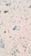 Flagelloscypha minutissima