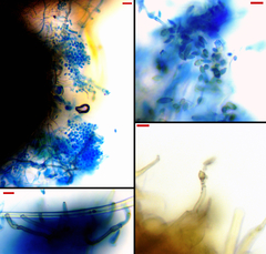 Phyllactinia alnicola