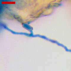 Phyllactinia alnicola