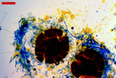 Phyllactinia alnicola