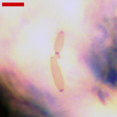 Phyllactinia alnicola