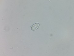 Cocconeis placentula