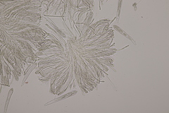 Strossmayeria basitricha