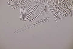 Strossmayeria basitricha