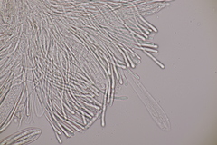 Strossmayeria basitricha