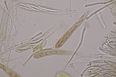 Strossmayeria basitricha