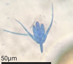 Tetracladium setigerum