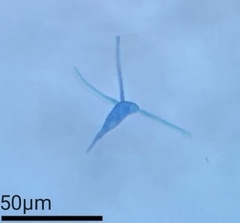 Culicidospora gravida