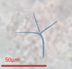 Alatospora acuminata