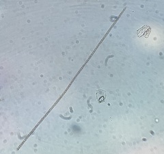 Planktothrix