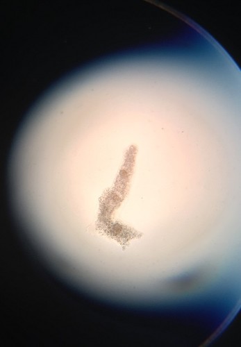 Amoeba (Amoeba proteus)