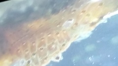 Watersipora cucullata