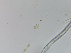 Cocconeis placentula