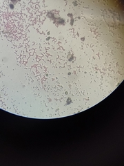 Escherichia coli