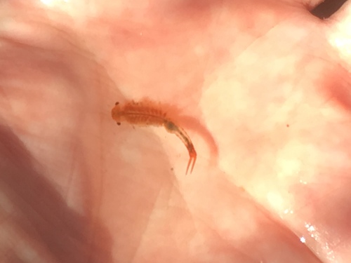 Anostraca