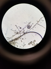 Cladosporium cladosporioides