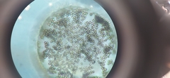 Aspergillus