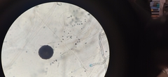 Aspergillus
