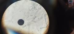 Aspergillus