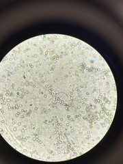 Trichoderma harzianum